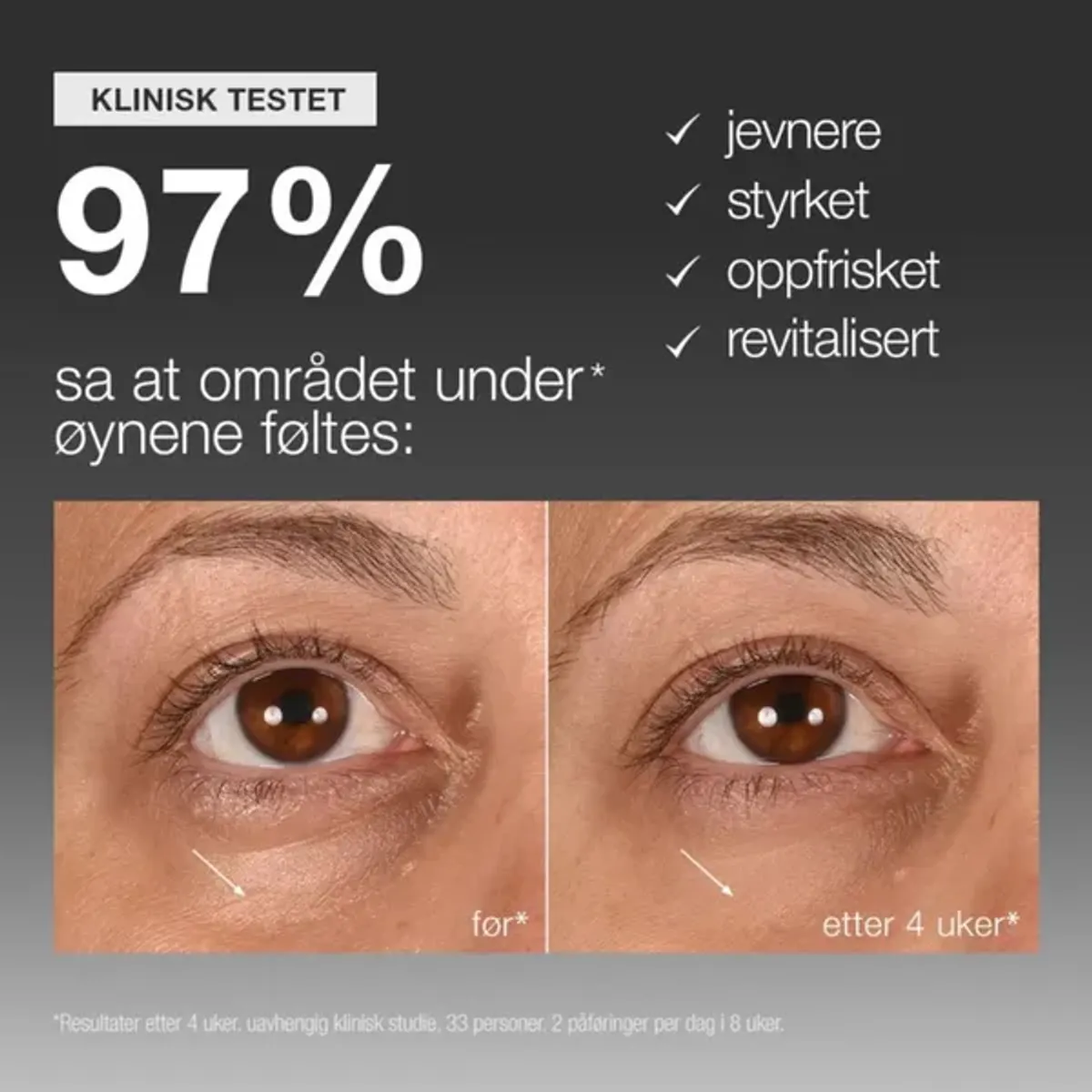 Smart Eye Density