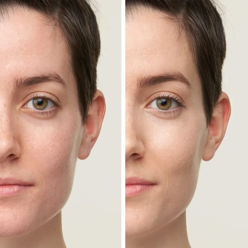 Active Light® Under-Eye Concealer